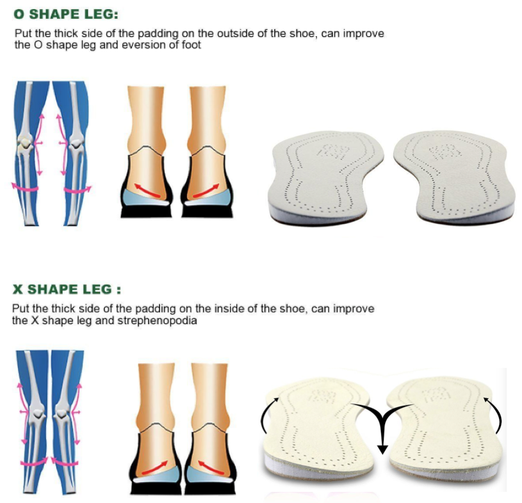 supination insoles boots