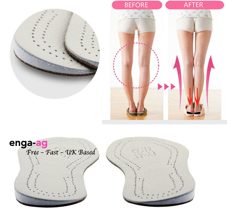 supination insoles for running